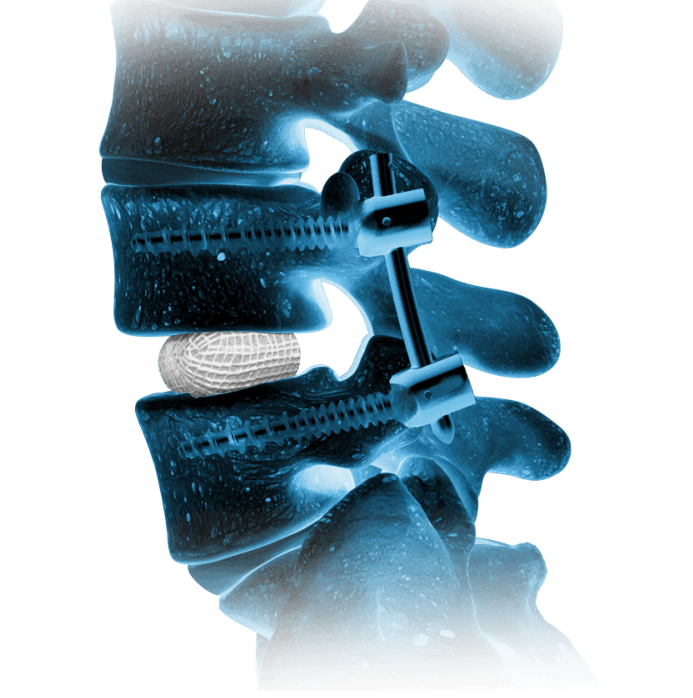 xray_Spineology_Home_Hero_2