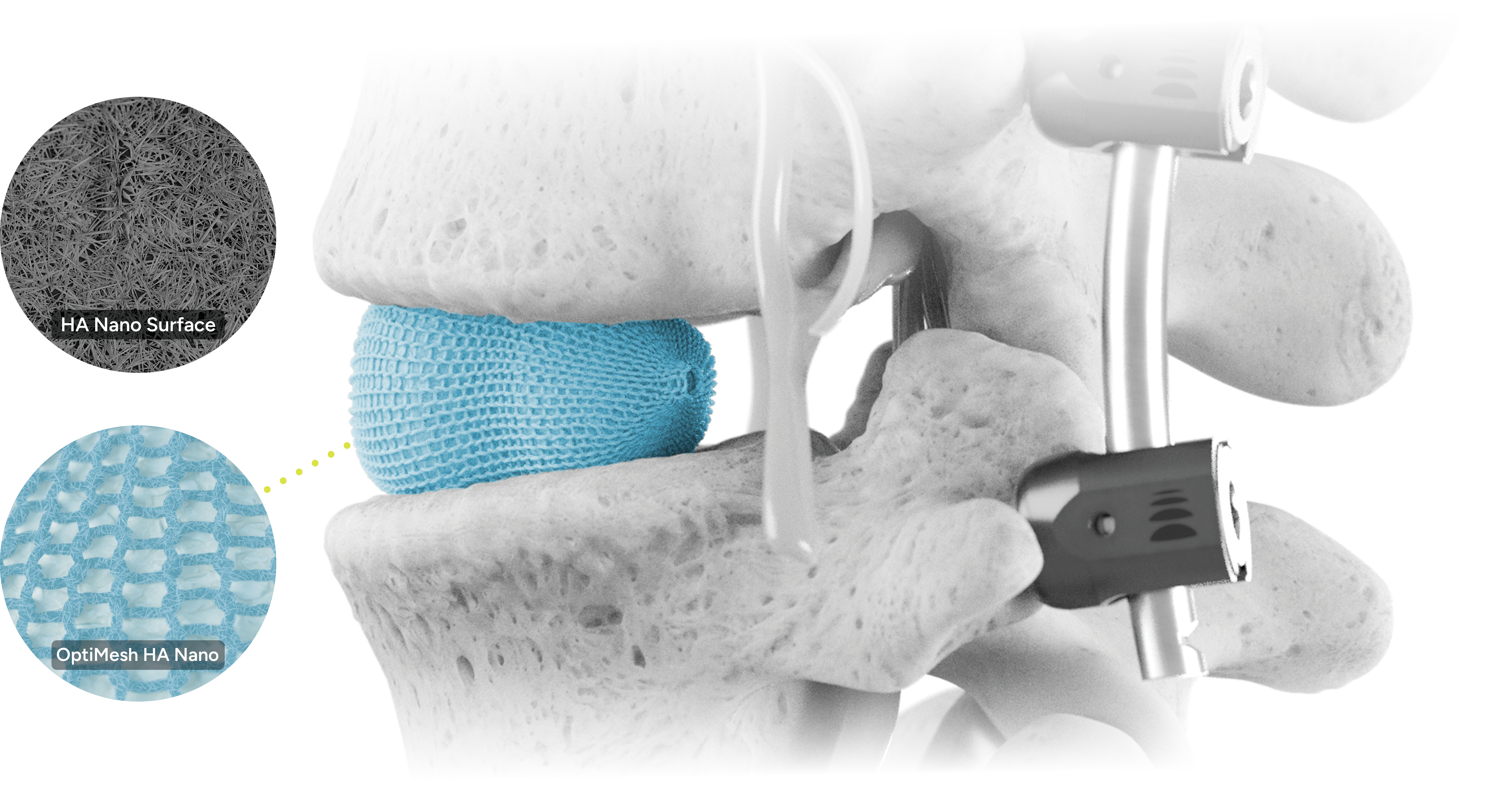 OptiMesh HA Nano web hero