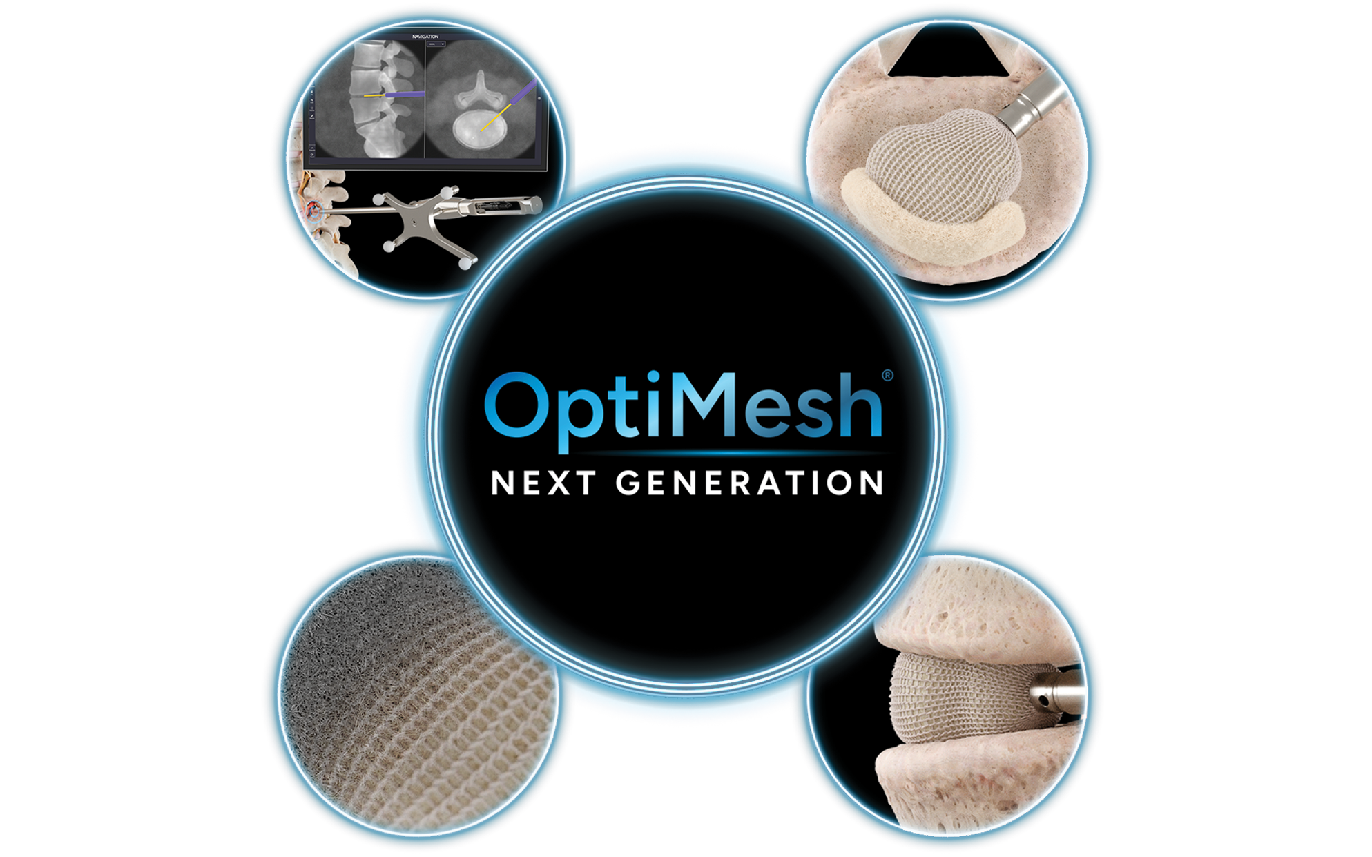 OptiMesh Next Generation Procedural Solution Brochure web